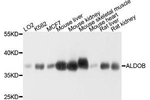 Western blot analysis of extracts of various cell lines, using ALDOB antibody (ABIN5971917) at 1/1000 dilution. (ALDOB antibody)