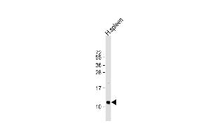 Anti-BP Antibody (N-term) at 1:1000 dilution + human spleen lysate Lysates/proteins at 20 μg per lane.