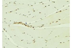 ABIN6276900 at 1/100 staining Mouse muscle tissue by IHC-P. (KEAP1 antibody  (N-Term))