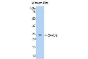 Western Blotting (WB) image for anti-Keratin 4 (KRT4) (AA 317-454) antibody (ABIN1172975)