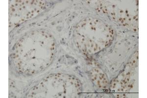 Immunoperoxidase of monoclonal antibody to CTNNBL1 on formalin-fixed paraffin-embedded human testis. (CTNNBL1 antibody  (AA 210-311))