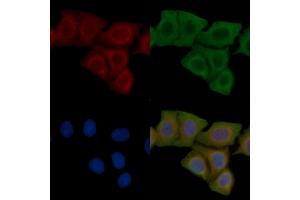 ABIN6258466 and ABIN6275185 staining Hela cells(45 min of heat-shock) by IF/ICC.