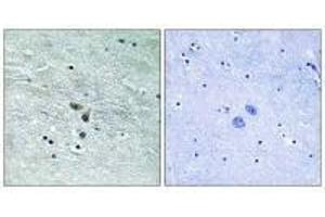 Immunohistochemistry analysis of paraffin-embedded human brain tissue using MAP3K8 (Ab-400) antibody. (MAP3K8 antibody  (Ser400))