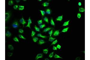 Immunofluorescence staining of Hela cells with ABIN7168990 at 1:141, counter-stained with DAPI. (STK3 antibody  (AA 323-450))