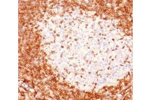 IHC testing of human tonsil stained with Bcl-2 antibody (8C8). (Bcl-2 antibody  (AA 41-54))