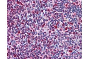 Anti-CHD4 antibody IHC of human tonsil. (CHD4 antibody  (AA 71-120))