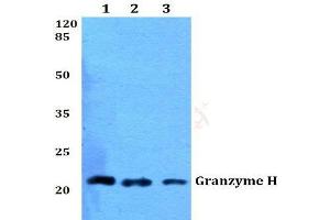 Western blot (WB) analysis of Granzyme H antibody  at 1/500 dilution. (GZMH antibody)