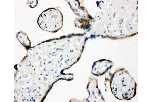 Anti-ERp57 antibody, IHC(P) IHC(P): Human Placenta Tissue (PDIA3 antibody  (Middle Region))