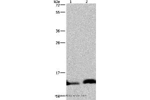 Western blot analysis of Human hepatocellular carcinoma and fetal brain tissue, using NDUFA5 Polyclonal Antibody at dilution of 1:400