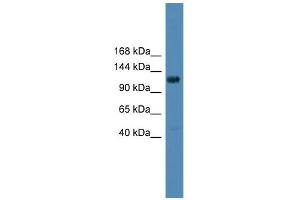 WB Suggested Anti-DGKQ Antibody Titration: 0. (DGKQ antibody  (Middle Region))