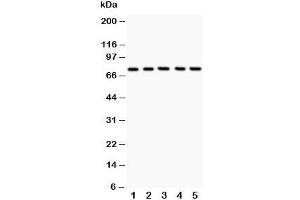 Western blot testing of 12 Lipoxygenase antibody and Lane 1:  A549;  2: MCF-7;  3: COLO320;  4: Jurkat;  5: HeLa;  Predicted size: 75KD;  Observed size: 75KD (12-Lipoxygenase antibody  (C-Term))