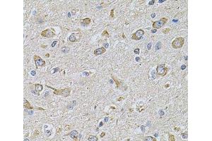 Immunohistochemistry of paraffin-embedded Rat brain using FASTKD1 Polyclonal Antibody at dilution of 1:100 (40x lens). (FASTKD1 antibody)
