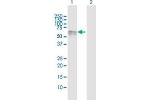 Western Blot analysis of DOK1 expression in transfected 293T cell line by DOK1 MaxPab polyclonal antibody. (DOK1 antibody  (AA 1-481))