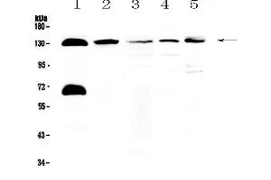 Western blot analysis of NEDD4-2 using anti-NEDD4-2 antibody . (NEDD4-2 antibody  (AA 703-975))