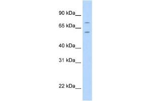 WB Suggested Anti-FOXK1 Antibody Titration:  2.