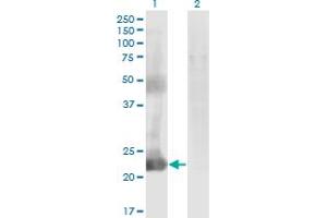 Western Blot analysis of CCDC115 expression in transfected 293T cell line by CCDC115 monoclonal antibody (M05), clone 4E9. (CCDC115 antibody  (AA 1-132))