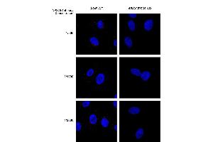 Immunocytochemistry/Immunofluorescence analysis using Mouse Anti-VPS35 Monoclonal Antibody, Clone 8A3 (ABIN6932968). (VPS35 antibody  (Biotin))