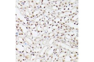 Immunohistochemistry of paraffin-embedded Mouse kidney using EP300 antibody (ABIN6127823, ABIN6140193, ABIN6140194 and ABIN6216844) at dilution of 1:100 (40x lens). (p300 antibody  (AA 1-270))