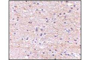 Immunohistochemistry of SATB2 in human brain with this product at 5 μg/ml. (SATB2 antibody  (N-Term))