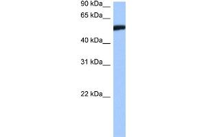 WB Suggested Anti-HMG20A Antibody   Titration: 1. (HMG20A antibody  (Middle Region))