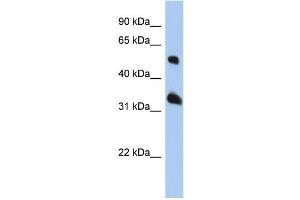 WB Suggested Anti-TSPAN33 Antibody Titration: 0. (TSPAN33 antibody  (Middle Region))