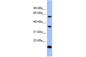 WB Suggested Anti-LAntibody Titration:  0. (LARP6 antibody  (Middle Region))