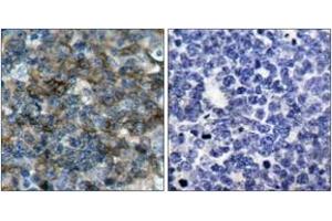 Immunohistochemistry analysis of paraffin-embedded human tonsil, using VASP (Phospho-Ser157) Antibody. (VASP antibody  (pSer157))
