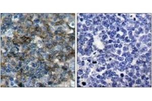 Immunohistochemistry analysis of paraffin-embedded human tonsil, using VASP (Phospho-Ser157) Antibody. (VASP antibody  (pSer157))