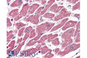 ABIN185710 (4µg/ml) staining of paraffin embedded Human Heart. (CPT1A antibody  (Internal Region))
