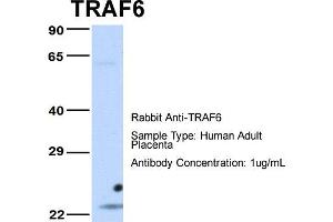 Host: Rabbit Target Name: TRAF6 Sample Type: Human Adult Placenta Antibody Dilution: 1. (TRAF6 antibody  (Middle Region))