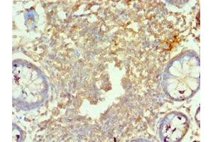 Immunohistochemistry of paraffin-embedded human colon tissue using ABIN7160219 at dilution of 1:100 (MORF4L1 antibody  (AA 1-100))