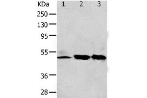 Western Blot analysis of 293T and K562 cell, Human fetal kidney tissue using F2R Polyclonal Antibody at dilution of 1:650 (PAR1 antibody)