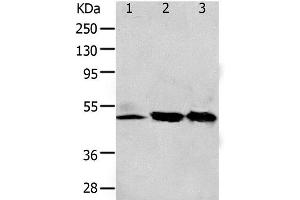 Western Blot analysis of 293T and K562 cell, Human fetal kidney tissue using F2R Polyclonal Antibody at dilution of 1:650 (PAR1 antibody)