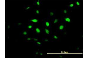 Immunofluorescence of purified MaxPab antibody to BCCIP on HeLa cell. (BCCIP antibody  (AA 1-322))