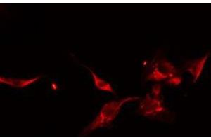 ABIN6275053 staining HeLa cells by IF/ICC. (DOCK1 antibody  (C-Term))