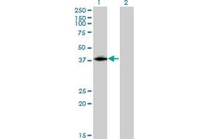 Western Blot analysis of ISL2 expression in transfected 293T cell line by ISL2 monoclonal antibody (M03), clone 1D9. (ISL2 antibody  (AA 261-358))