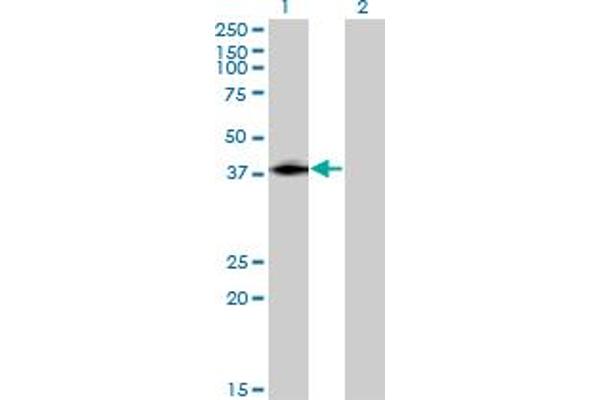 ISL2 anticorps  (AA 261-358)