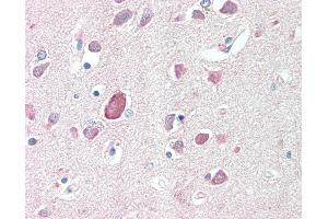Anti-PTGDS / PGDS antibody IHC staining of human brain, cortex. (PTGDS antibody  (AA 27-38))