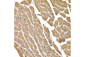 Immunohistochemistry of paraffin-embedded mouse heart using SLC2A4 antibody (ABIN5995371) at dilution of 1/100 (40x lens). (GLUT4 antibody)