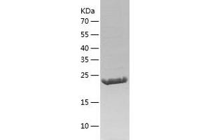 Western Blotting (WB) image for RAB38, Member RAS Oncogene Family (RAB38) (AA 2-211) protein (His tag) (ABIN7286566) (RAB38 Protein (AA 2-211) (His tag))