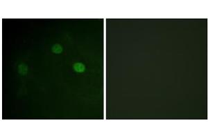 Immunofluorescence analysis of COS7 cells, using CDK1 (Phospho-Thr14) antibody. (CDK1 antibody  (pThr14))