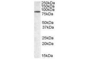 Image no. 1 for anti-Tripartite Motif Containing 3 (TRIM3) (N-Term) antibody (ABIN374306)