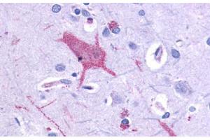 Anti-GRM1 / MGLUR1 antibody  ABIN1048927 IHC staining of human brain, neurons and glia.