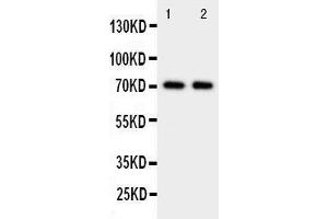 Anti-Prolactin Receptor antibody, Western blotting Lane 1: HELA Cell Lysate Lane 2: MCF-7 Cell Lysate (Prolactin Receptor antibody  (C-Term))