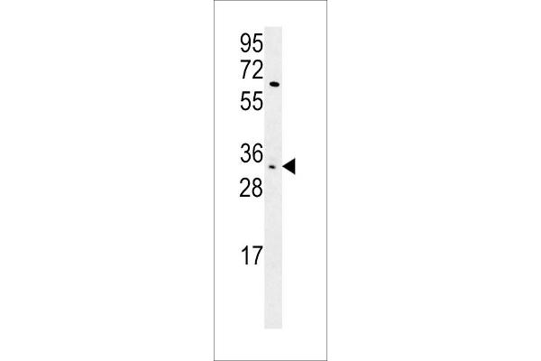 KIR2DS3 antibody  (C-Term)