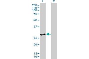 Western Blot analysis of IFIH1 expression in transfected 293T cell line by IFIH1 MaxPab polyclonal antibody. (IFIH1 antibody  (AA 1-221))