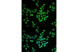 Immunofluorescence (IF) image for anti-Mitochondrial Ribosomal Protein L28 (MRPL28) antibody (ABIN1876936)