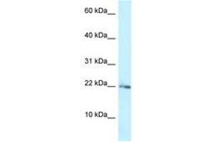 Image no. 1 for anti-Ribosomal Protein L23A (RPL23A) (AA 33-82) antibody (ABIN6747774) (RPL23A antibody  (AA 33-82))