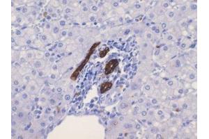Immunohistochemistry (IHC) image for anti-Keratin 19 (KRT19) (C-Term) antibody (ABIN870576) (Cytokeratin 19 antibody  (C-Term))