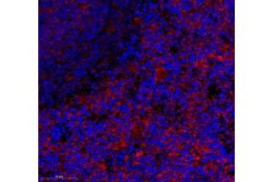Immunofluorescence of paraffin embedded rat spleen using CD163b (ABIN7073371) at dilution of 1: 700 (350x lens) (CD163L1 antibody)